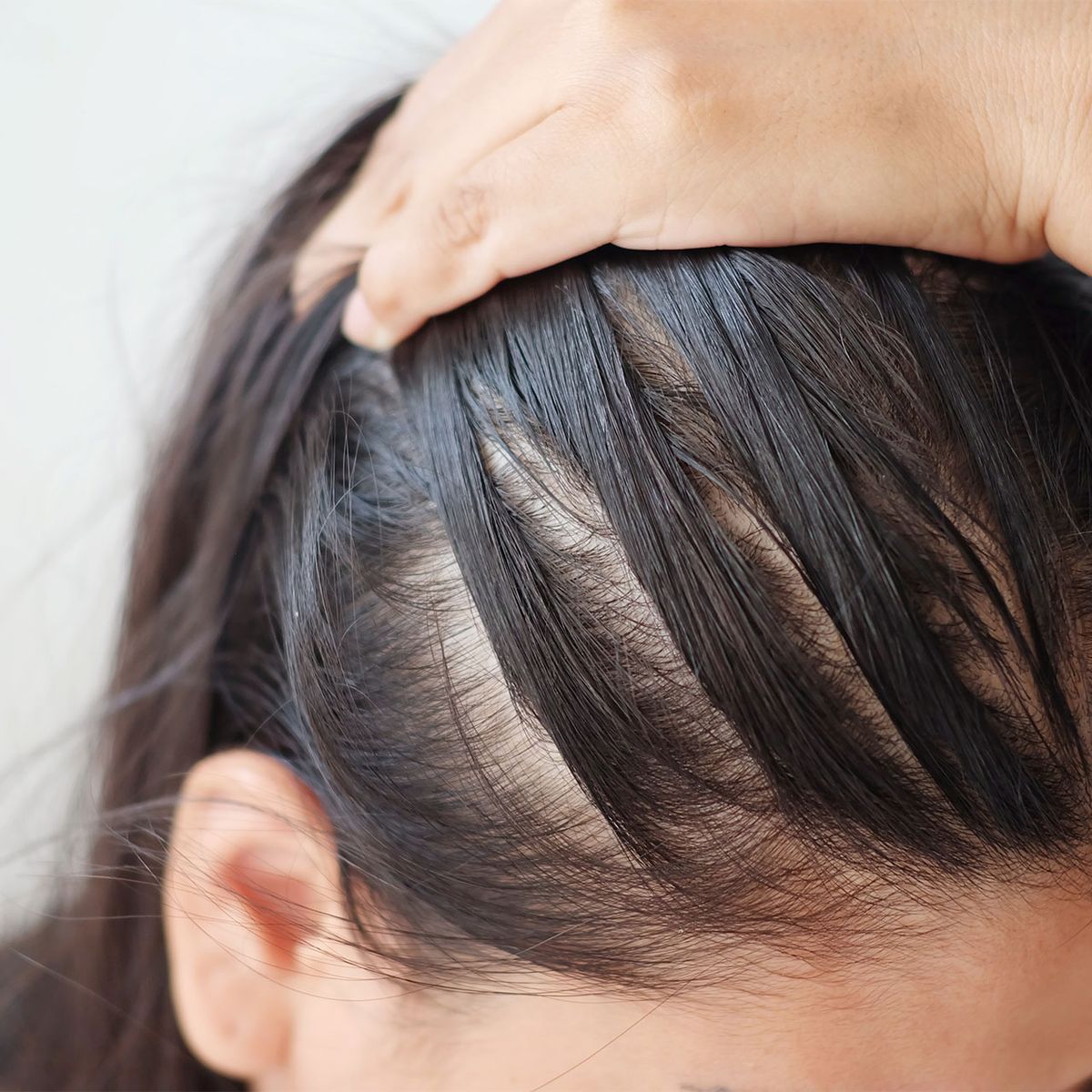 Hair Density & Treatment Module